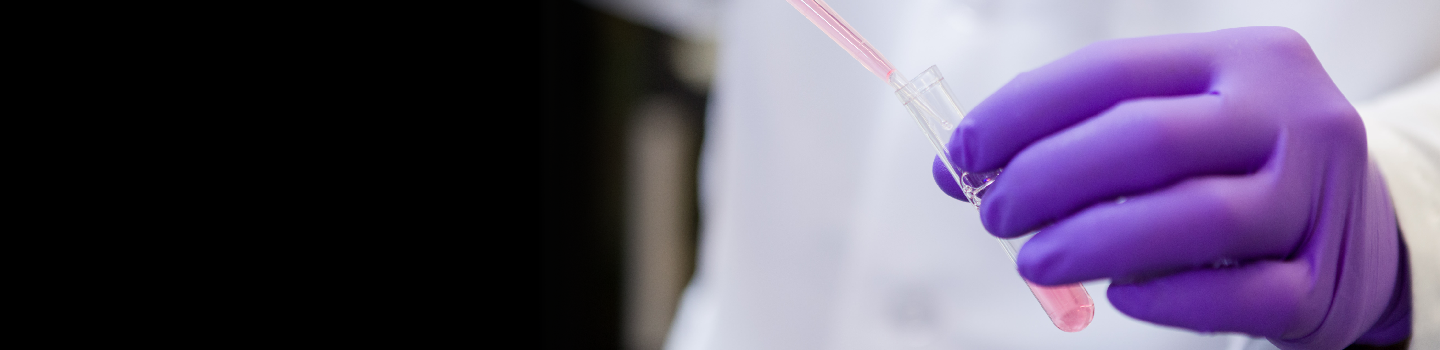 Matrix Screening Project. A scientist's hands with the lab equipment.